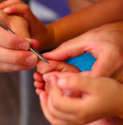 how to remove a splinter without tears