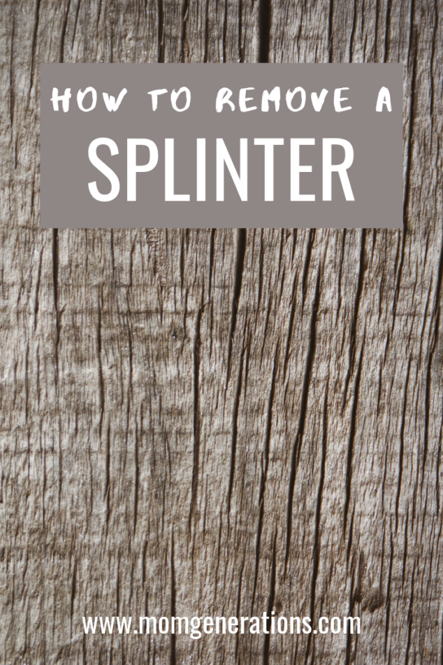 How to Remove a Splinter