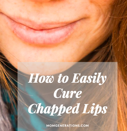 How to Cure Chapped Lips - Stylish Life for Moms